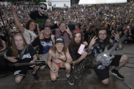 VULVODYNIA